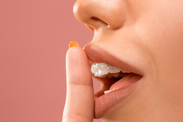 Image showing Beautiful young woman with teeth braces