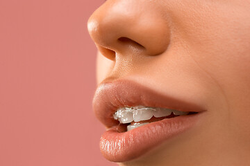 Image showing Beautiful young woman with teeth braces