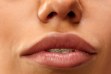 Image showing Beautiful young woman with teeth braces