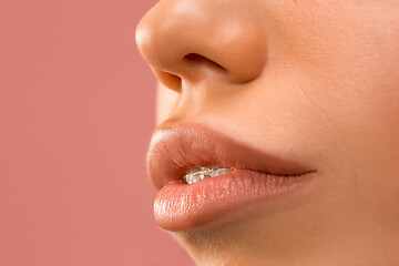 Image showing Beautiful young woman with teeth braces