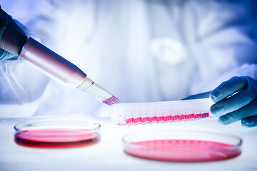 Image showing Nurse holding test tube with blood for 2019-nCoV analyzing. Novel Chinese Coronavirus blood test Concept.