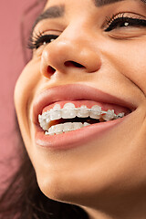 Image showing Beautiful young woman with teeth braces