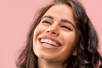 Image showing Beautiful young woman with teeth braces