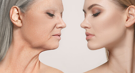 Image showing Comparison. Portrait of beautiful woman with problem and clean skin, aging and youth concept, beauty treatment