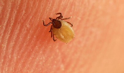 Image showing Tick on skin