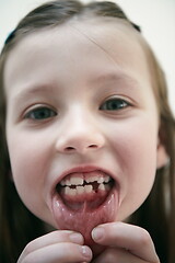 Image showing little girl without tooth smiling