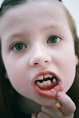 Image showing little girl without tooth smiling