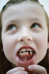 Image showing little girl without tooth smiling