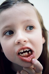 Image showing little girl without tooth smiling