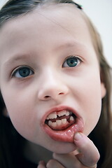 Image showing little girl without tooth smiling