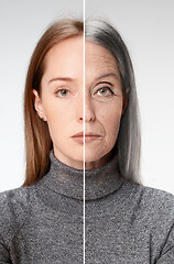 Image showing Comparison. Portrait of beautiful woman with problem and clean s