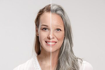 Image showing Comparison. Portrait of beautiful woman with problem and clean skin, aging and youth concept, beauty treatment