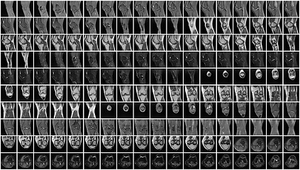 Image showing Complete Magnetic resonance imaging (MRI) of leftt knee