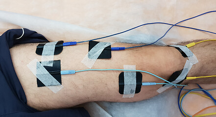 Image showing Electrostimulation of the quadriceps as a physiotherapy therapy 