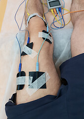 Image showing Electrostimulation of the quadriceps as a physiotherapy therapy 