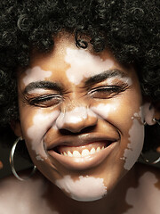 Image showing Studio portrait of african-american woman with vitiligo skin, beauty concept