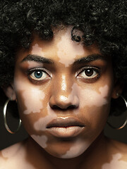 Image showing Studio portrait of african-american woman with vitiligo skin, beauty concept