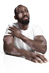 Image showing Studio portrait of african-american man with vitiligo skin, beauty concept