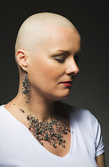 Image showing beautiful middle age woman cancer patient without hair
