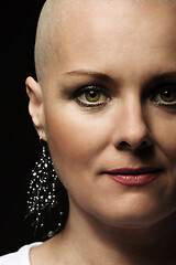 Image showing beautiful middle age woman cancer patient without hair