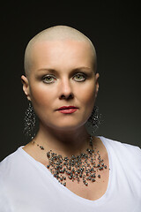 Image showing beautiful middle age woman cancer patient without hair