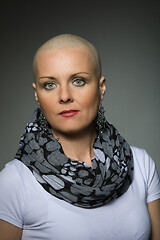 Image showing beautiful middle age woman cancer patient without hair