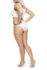 Image showing Female body with the drawing arrows. Fat lose, liposuction and cellulite removal concept