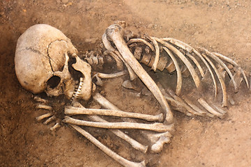 Image showing human skull