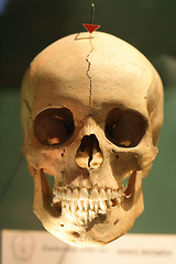 Image showing human skull