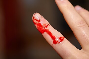 Image showing Cut finger bleeding