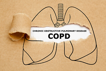 Image showing Chronic Obstructive Pulmonary Disease COPD Concept