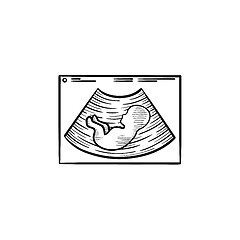 Image showing Baby silhouette on ultrasound hand drawn outline doodle icon.