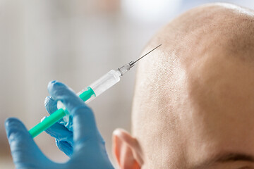 Image showing close up of hands with syringe and bald male head