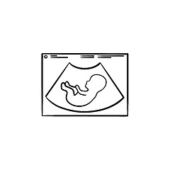 Image showing Fetal ultrasound hand drawn outline doodle icon.