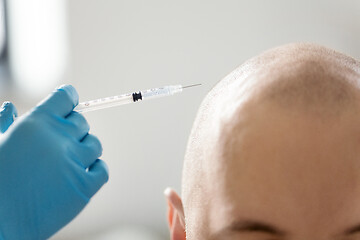 Image showing close up of hands with syringe and bald male head