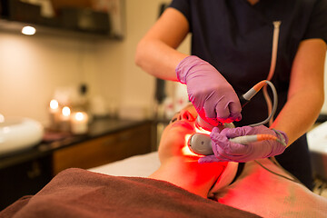 Image showing young woman having face microdermabrasion at spa