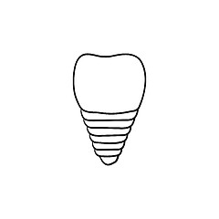 Image showing Dental implant hand drawn outline doodle icon.