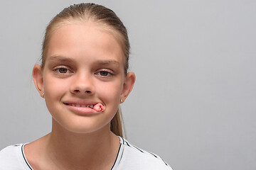 Image showing Portrait of a ten-year-old girl with a tampon that sticks out of her mouth after tooth extraction