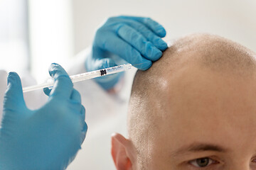 Image showing close up of hands with syringe and bald male head