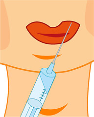 Image showing Increase the lips by means of botox procedure