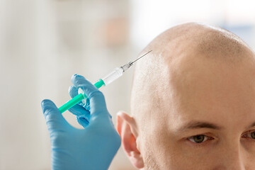 Image showing close up of hands with syringe and bald male head