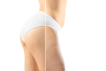 Image showing Overweight woman with fat cellulite legs and buttocks, obesity female body in white underwear comparing with fit and thin body isolated on white background