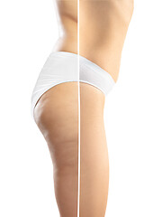 Image showing Overweight woman with fat cellulite legs and buttocks, obesity female body in white underwear comparing with fit and thin body isolated on white background