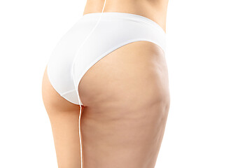 Image showing Overweight woman with fat cellulite legs and buttocks, obesity female body in white underwear comparing with fit and thin body isolated on white background