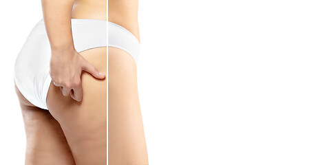 Image showing Overweight woman with fat cellulite legs and buttocks, obesity female body in white underwear comparing with fit and thin body isolated on white background