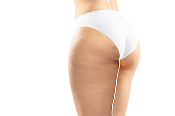 Image showing Overweight woman with fat cellulite legs and buttocks, obesity female body in white underwear comparing with fit and thin body isolated on white background