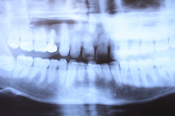 Image showing teeth