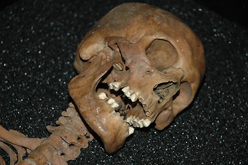 Image showing Skull