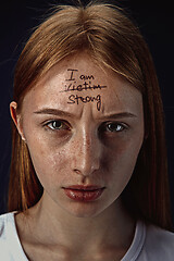 Image showing Young woman with mental health problems