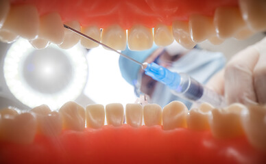 Image showing Patient at a dentist appointment in a dental clinic. View from i